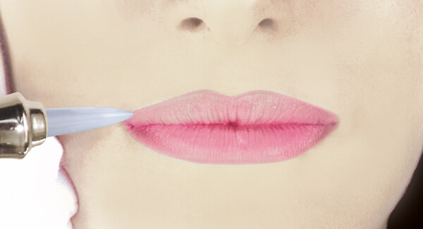 Pigmentierung an den Lippen